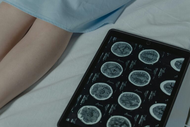 De ce sa apelam la experti in neurologie